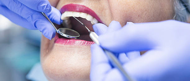 Best Chipped Tooth Repair Near Me  in Puyallup, WA